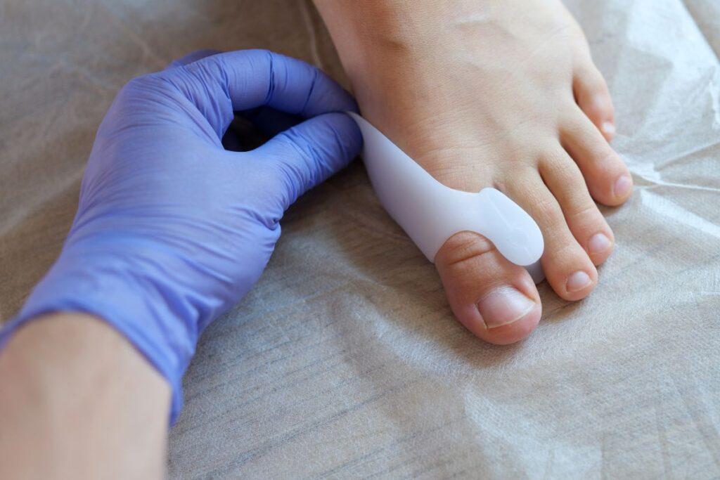 hallux valgus course a pied (3)