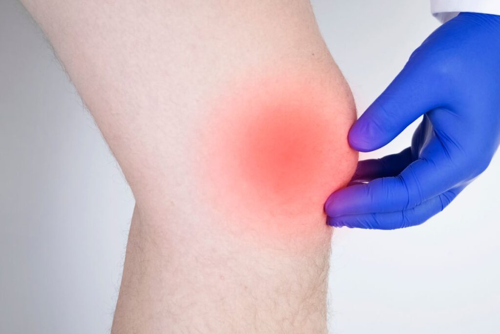 oedeme osseux temps guerison (5)