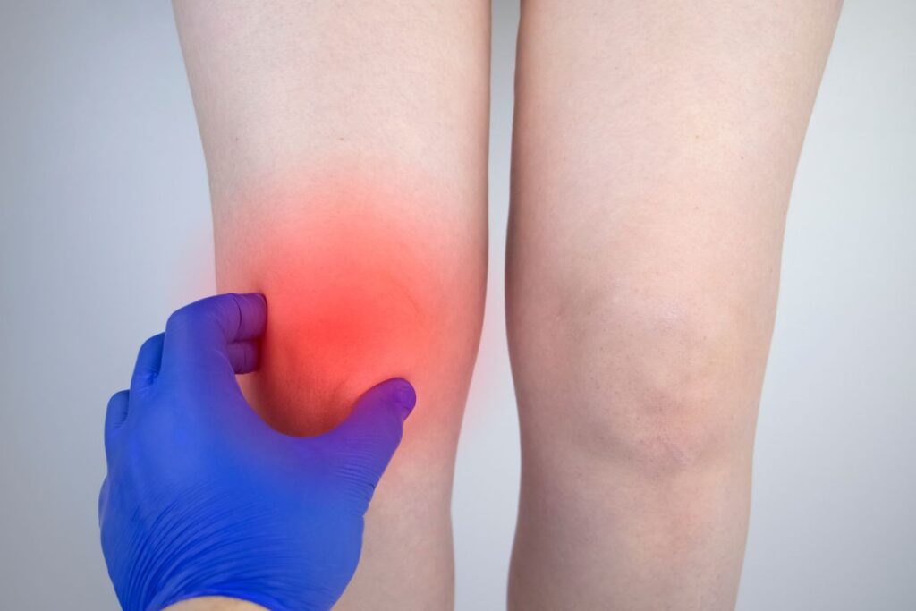 oedeme osseux temps guerison (6)