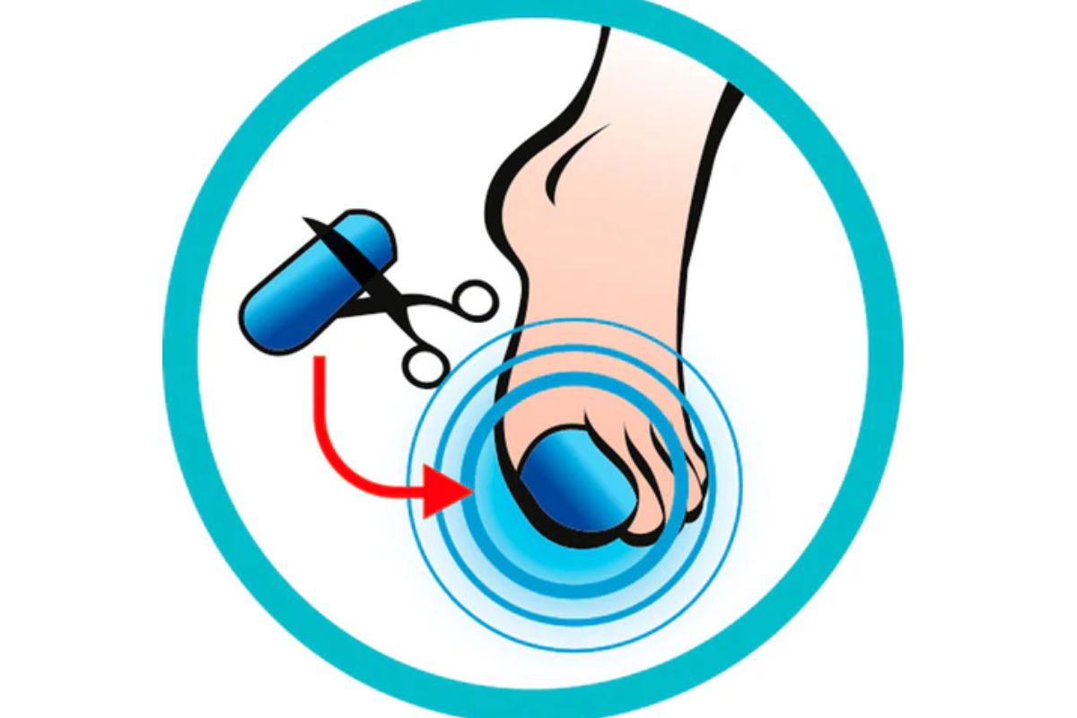 capuchon ongle course a pied (6)