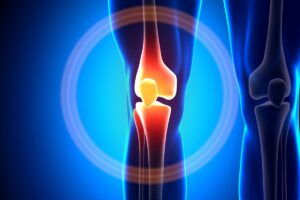 temps guerison syndrome essuie glace