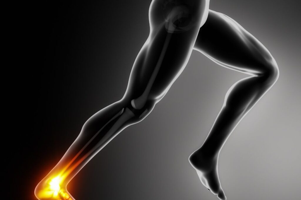 tendinite tendon achille (2)