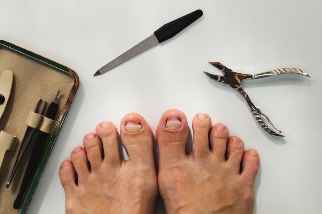 abandon utmb cause (2)